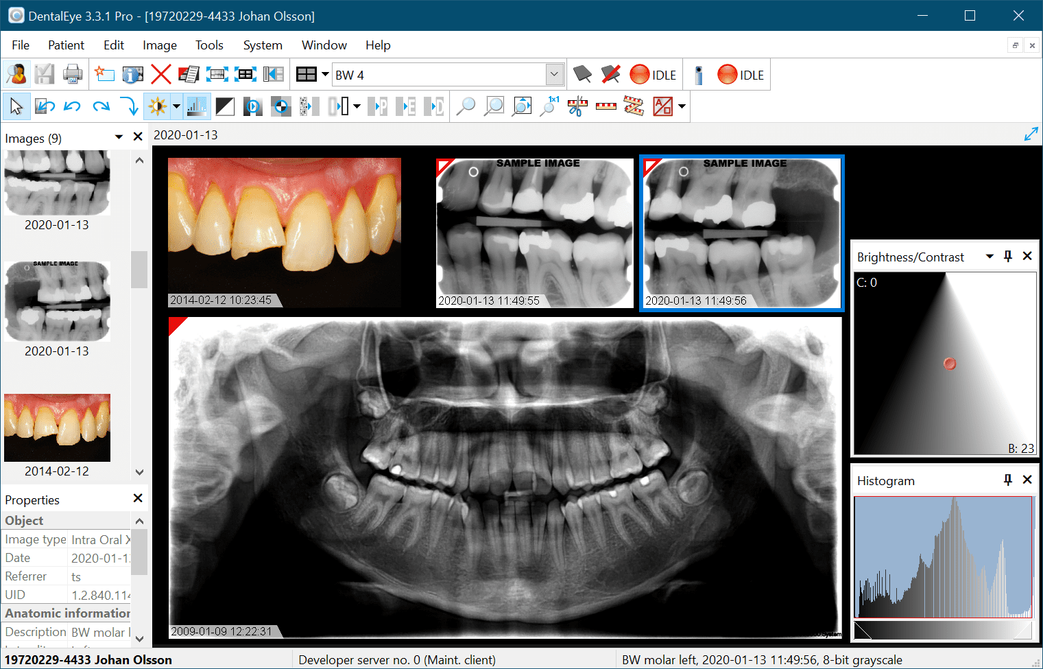 Dentaleye ENG DentalEye
